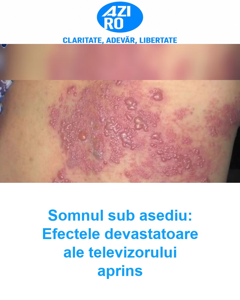 Somnul sub asediu: Efectele devastatoare ale televizorului aprins