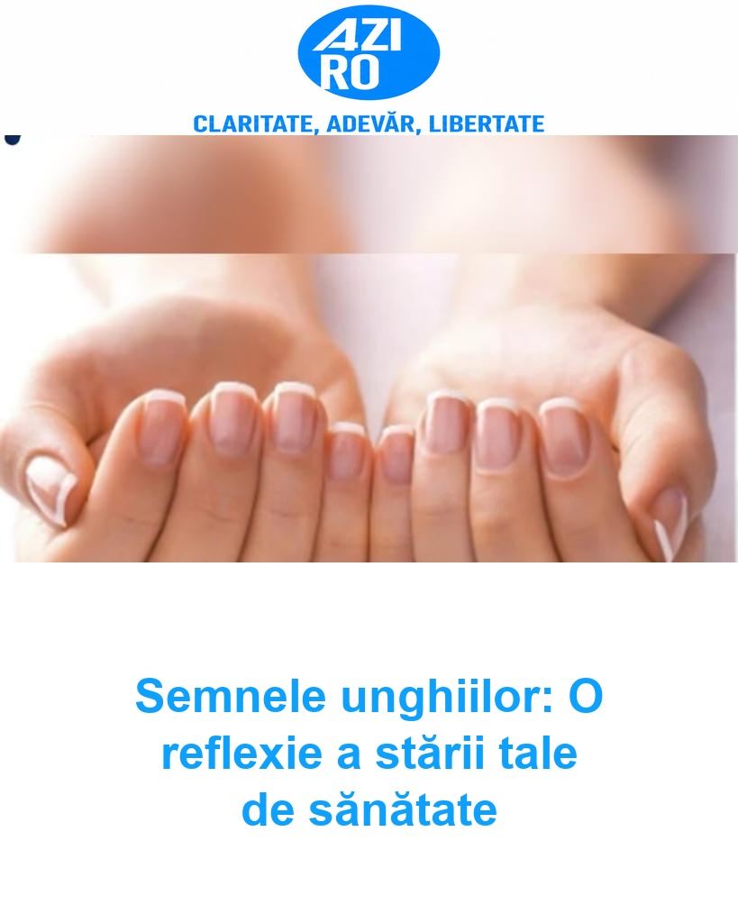 Semnele unghiilor: O reflexie a stării tale de sănătate